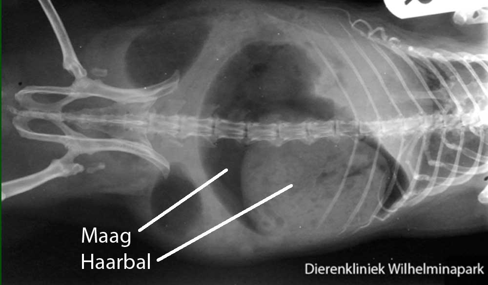 Op deze rontgenfoto is een grote haarbal in de maag te zien